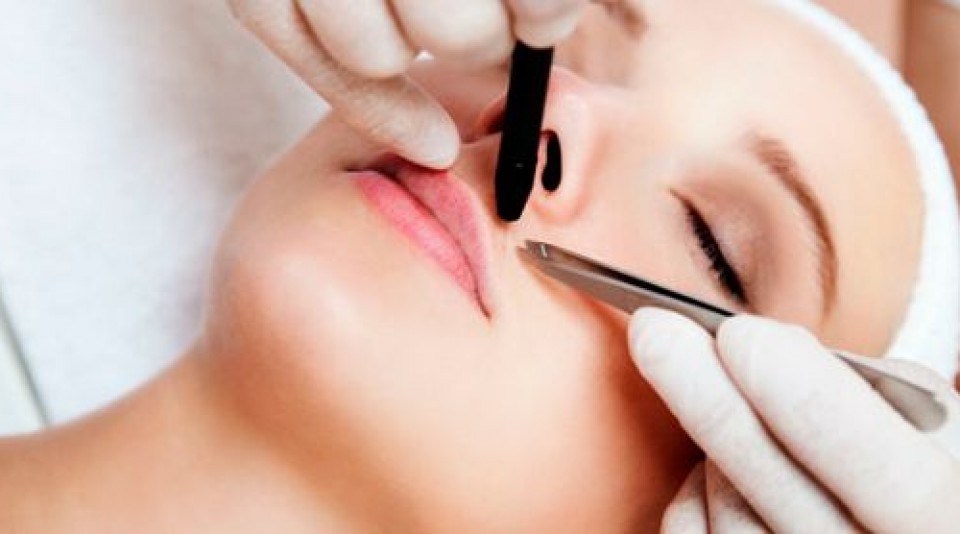 Depilación Eléctrica Valencia